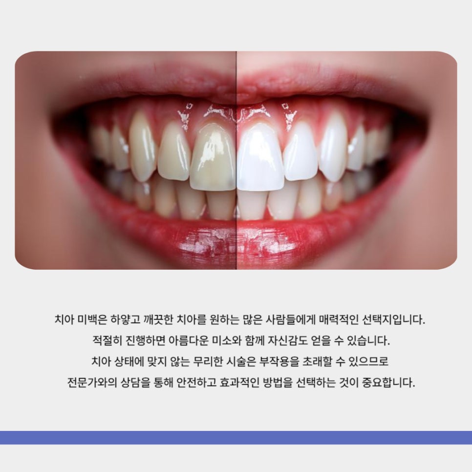 치아 미백 효과와 부작용 체크해야 할 사항 관련 이미지 7