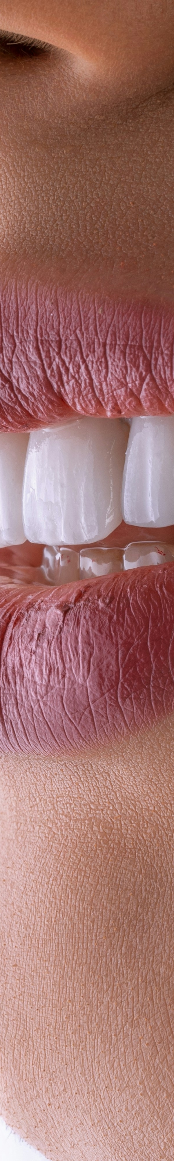 치아교정 후 유지 장치의 필요성 관련 이미지 23