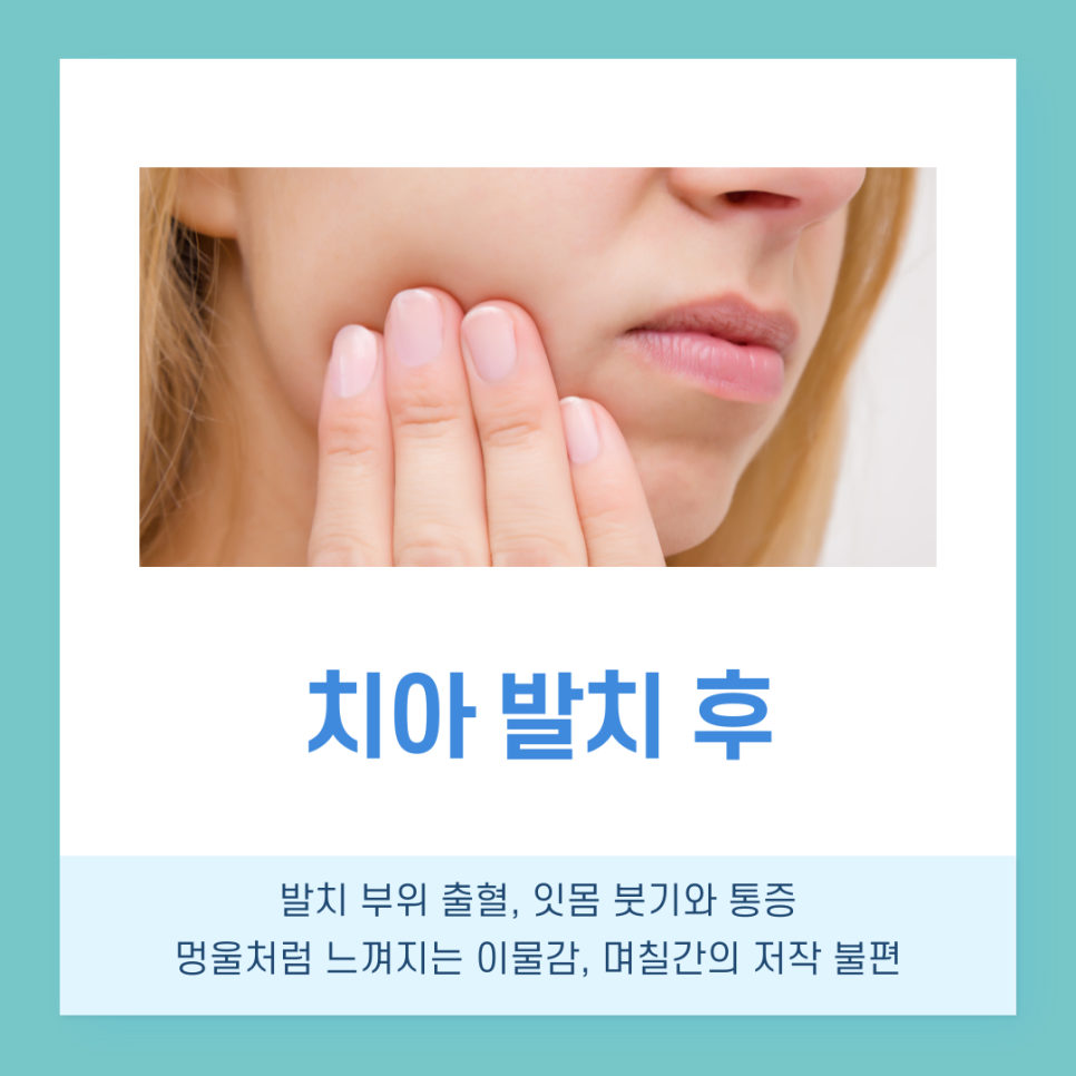 논현역치과 치아 발치 후 음주, 회복에 미치는 영향 관련 이미지 3