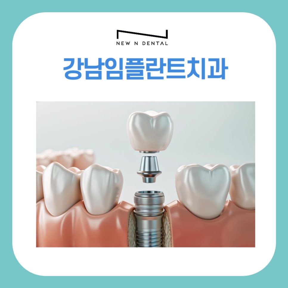 강남임플란트치과 치료부터 뼈이식까지 관련 이미지 1