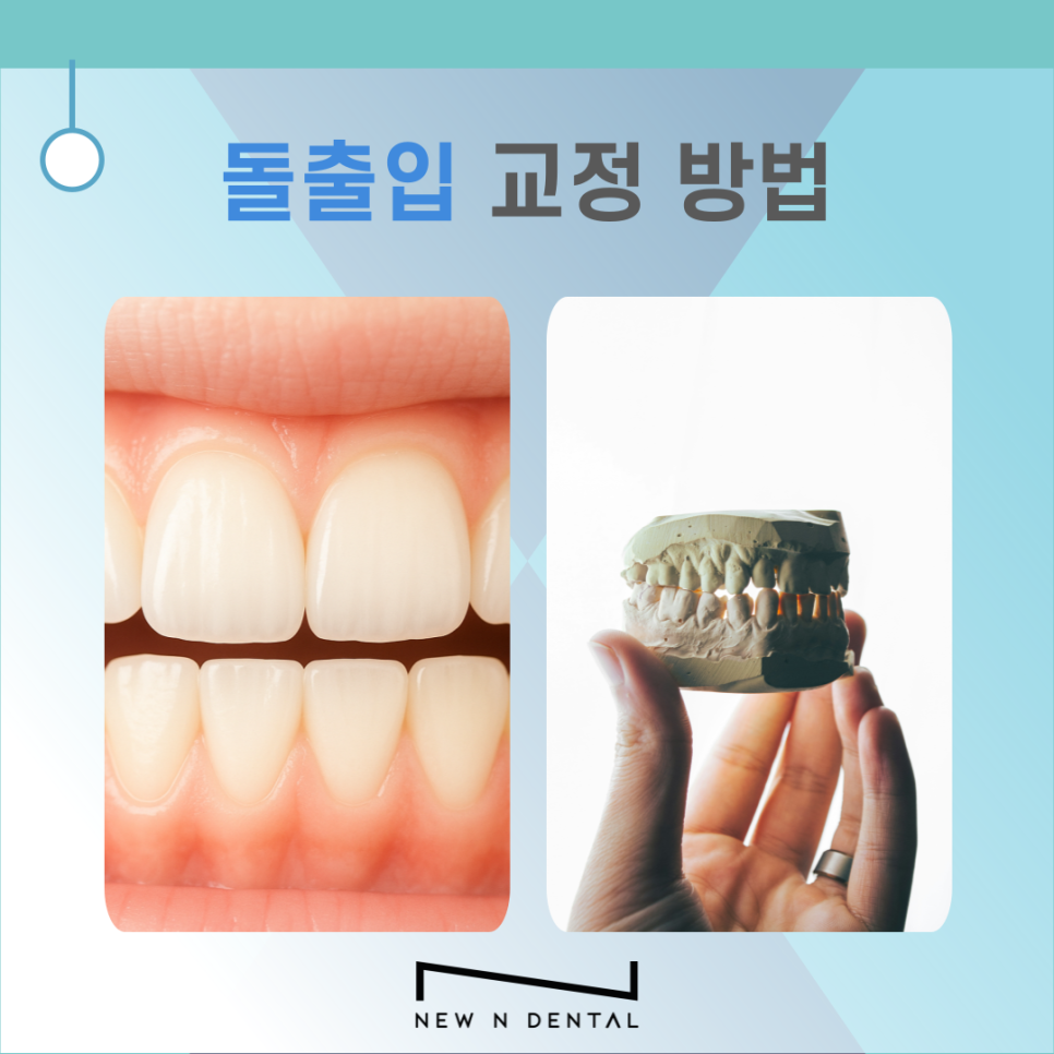 돌출입 교정 치과 비용, 치료 전 꼭 알아야 할 점 관련 이미지 3