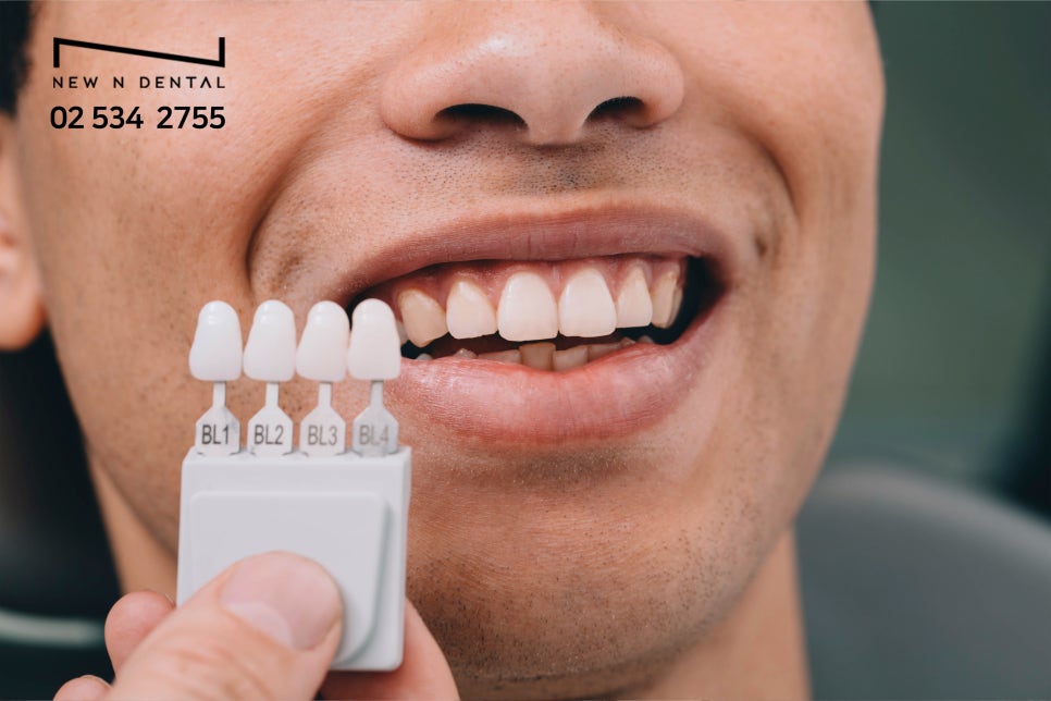 강남라미네이트 첫인상을 결정짓는 요소 관련 이미지 4