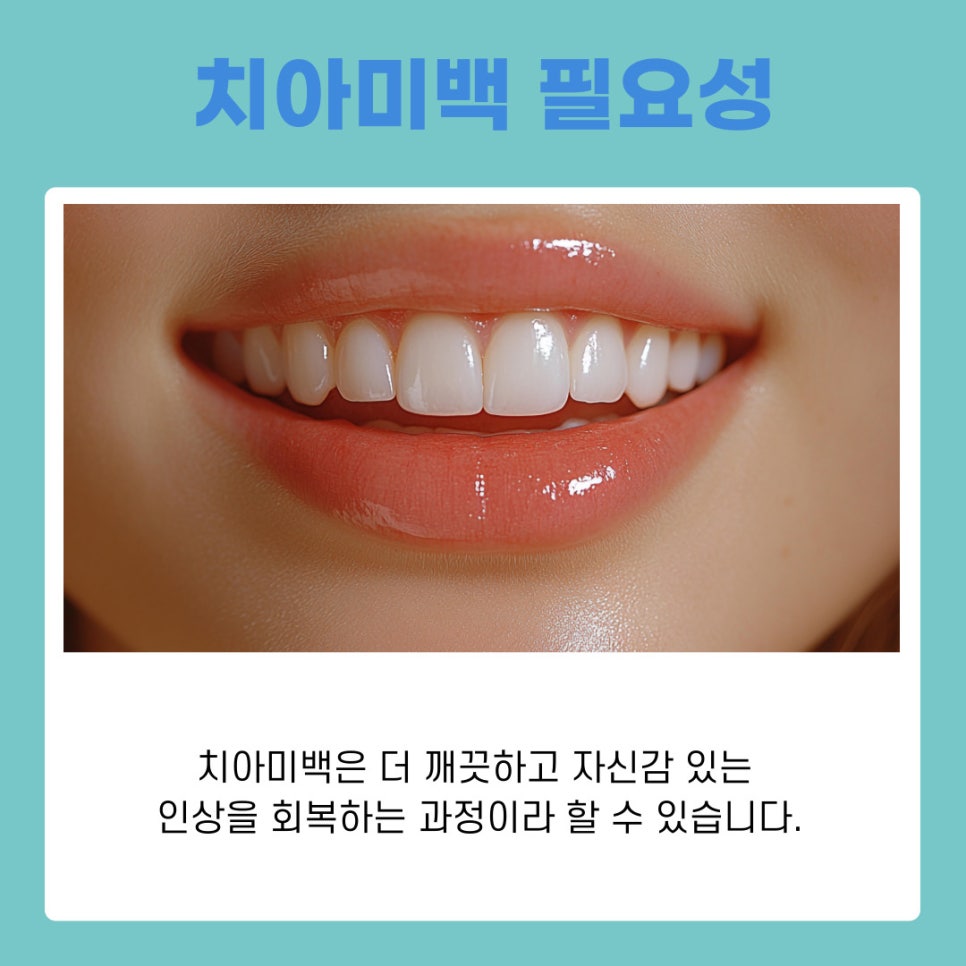 강남역치과 치아미백 원리부터 관리 방법 까지 관련 이미지 3