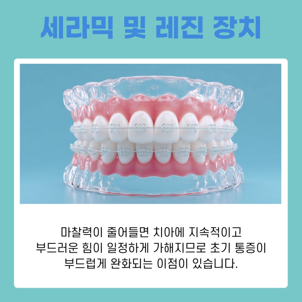 A Guide to Choosing the Right Orthodontic Appliance for You from a Yeoksam-dong Orthodontic Clinic image 7