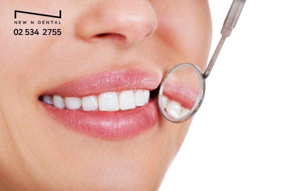 서울치아미백 입꼬리가 올라가는 마법 관련 이미지 6