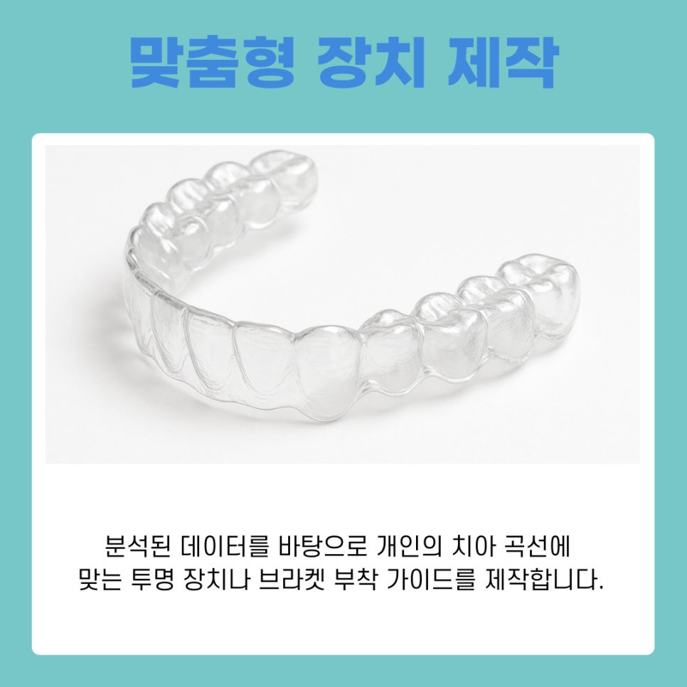 Digital Orthodontic Guide from Seocho Station Dental Clinic image 7