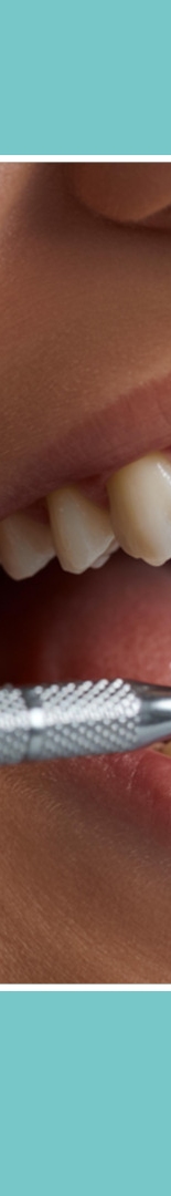 Seocho-dong Dental Clinic: Dental Regular Checkups and How to Prevent Cavities Properly image 11