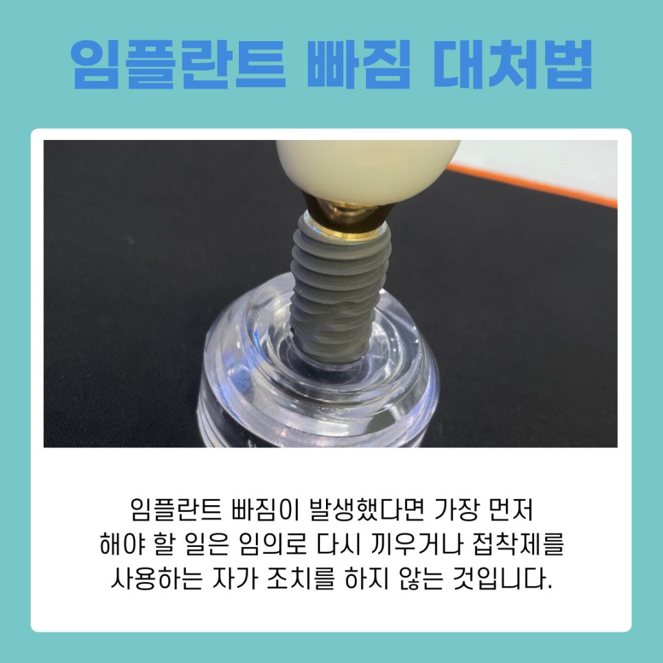 강남논현동치과 임플란트 빠짐 원인과 재치료 가능성 정리 관련 이미지 6