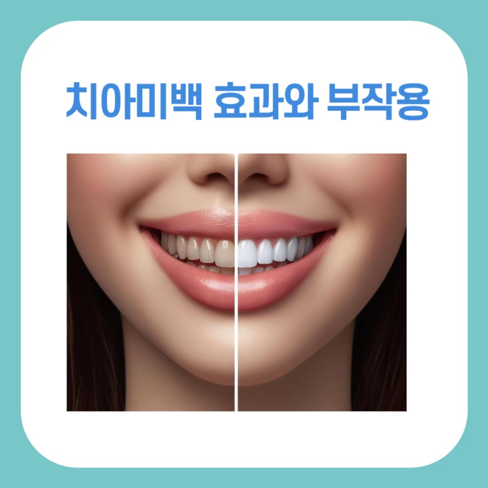 치아 미백 효과와 부작용 체크해야 할 사항 관련 이미지 1