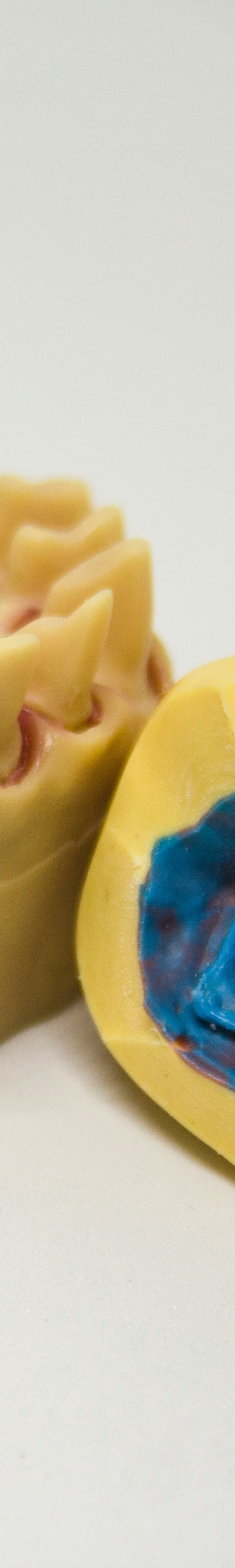 임플란트 후 관리의 중요성 관련 이미지 24