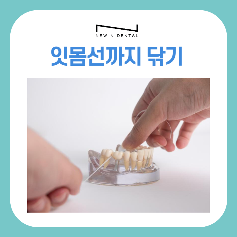 건강한 구강을 위한 치아관리방법, 치실사용순서 제대로 알기 관련 이미지 8