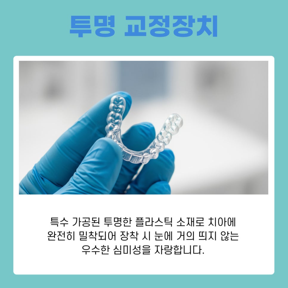 A Guide to Choosing the Right Orthodontic Appliance for You from a Yeoksam-dong Orthodontic Clinic image 9