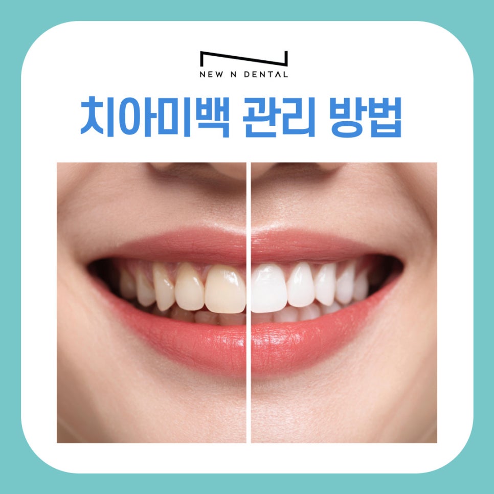 강남역치과 치아미백 원리부터 관리 방법 까지 관련 이미지 2
