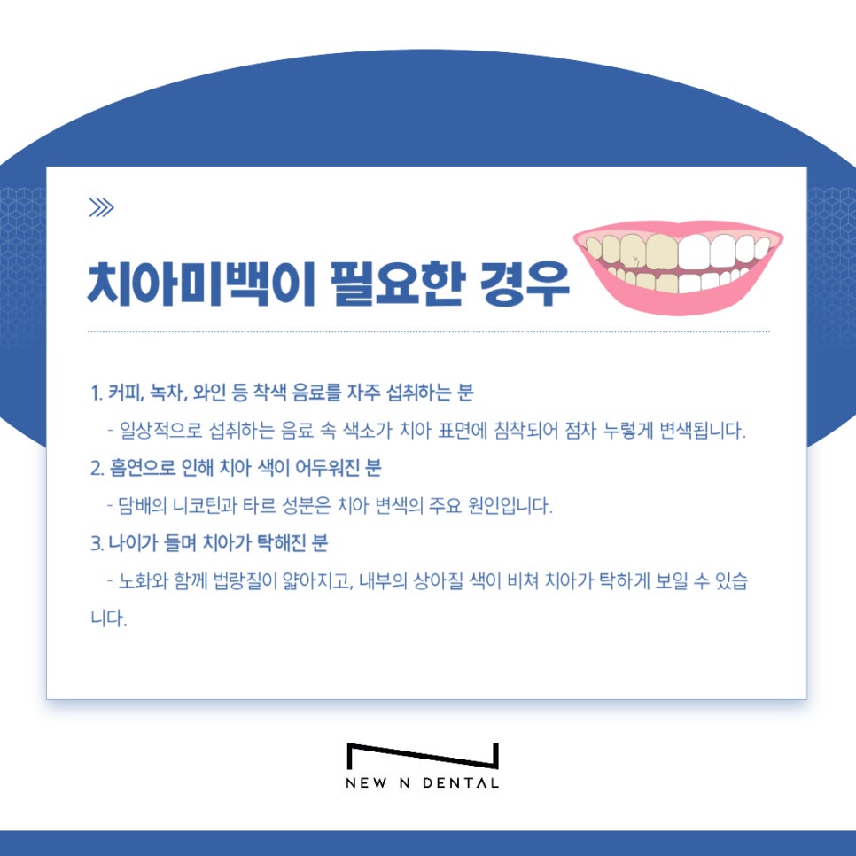 강남치과 치아미백, 누런치아 하얗게 만드는 방법은 관련 이미지 3