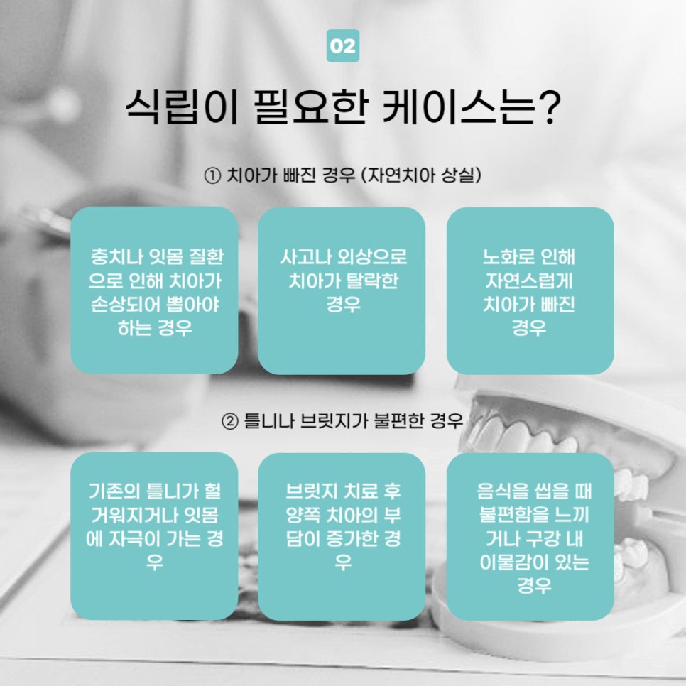 강남임플란트추천 식립 고민중이라면 관련 이미지 3