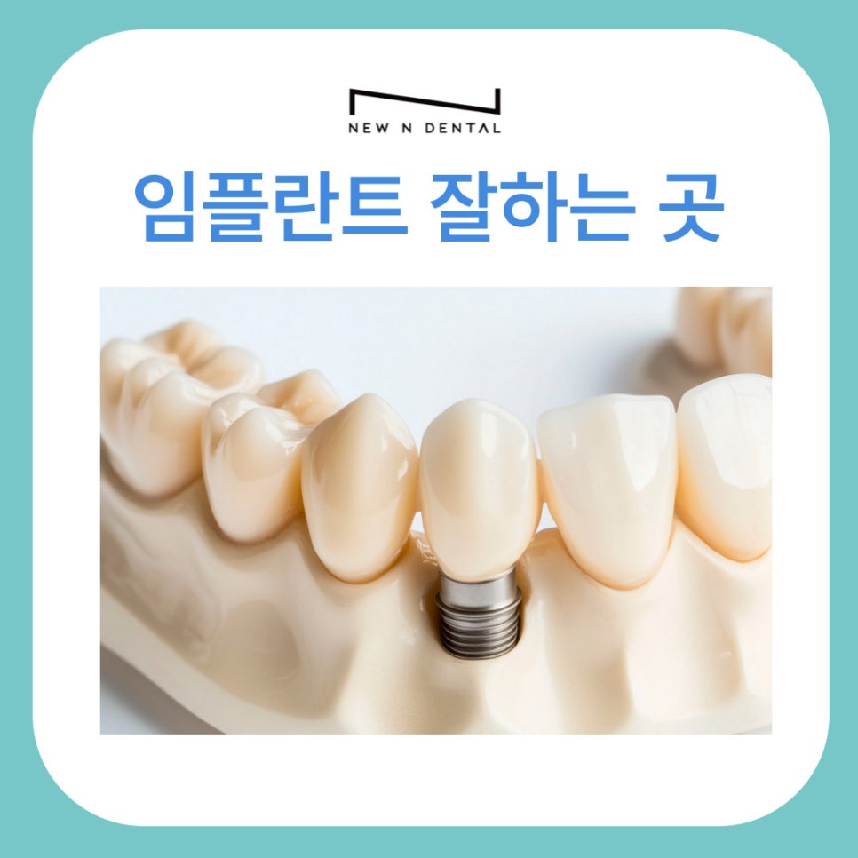 강남임플란트잘하는곳 선택 기준 및 진료 환경 관련 이미지 1