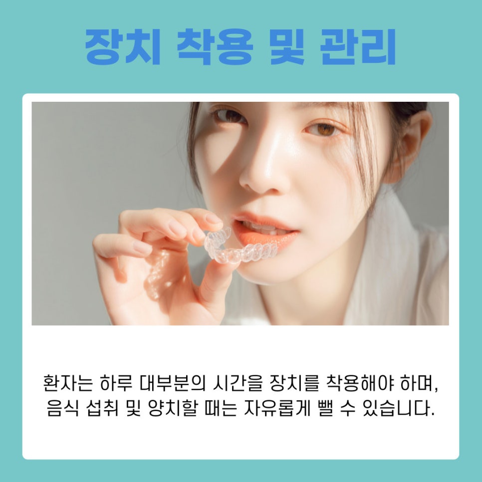 앞니투명교정, 강남치아교정치과에서 궁금증 해결하기 관련 이미지 7