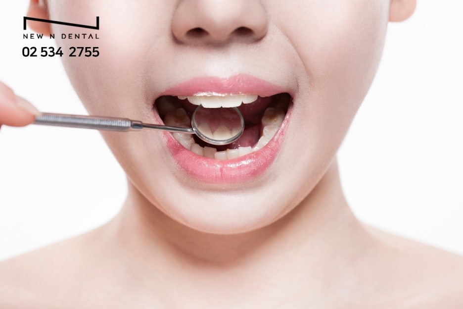 신논현임플란트 선택 후 달라진 일상 관련 이미지 6