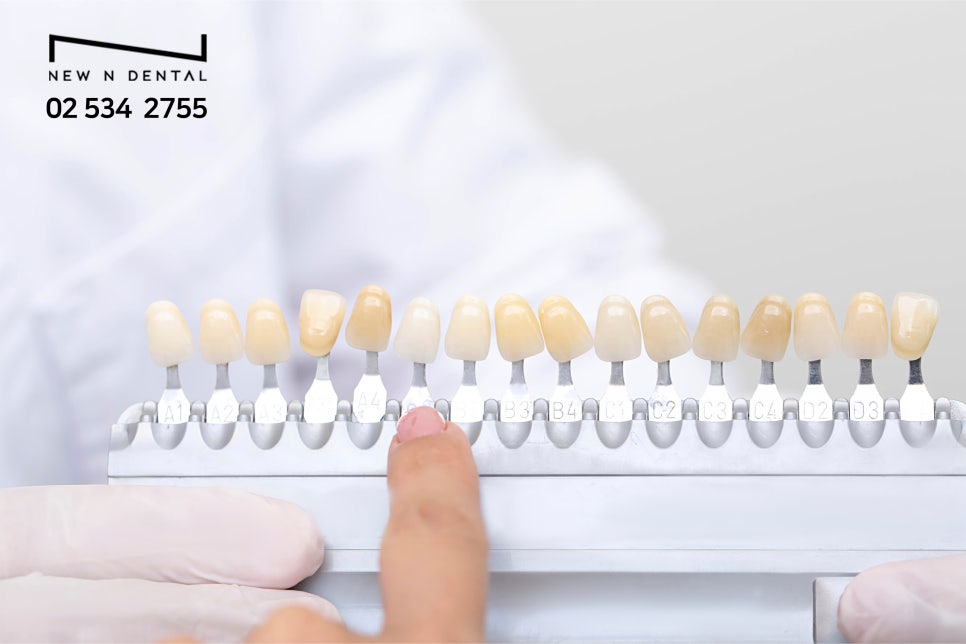 무삭제라미네이트비용 전반적인 안내 사항 관련 이미지 4