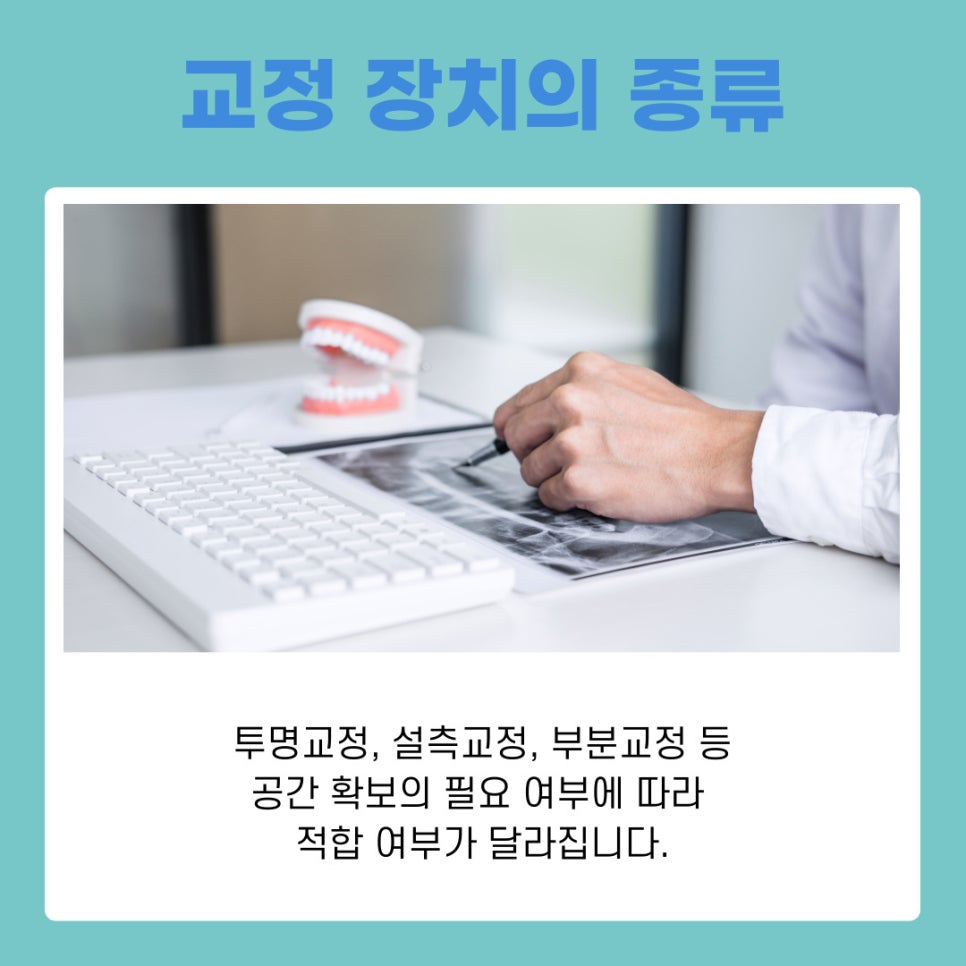 강남역교정치과 상담 받기 전 알아두면 유용한 교정 가이드 관련 이미지 4