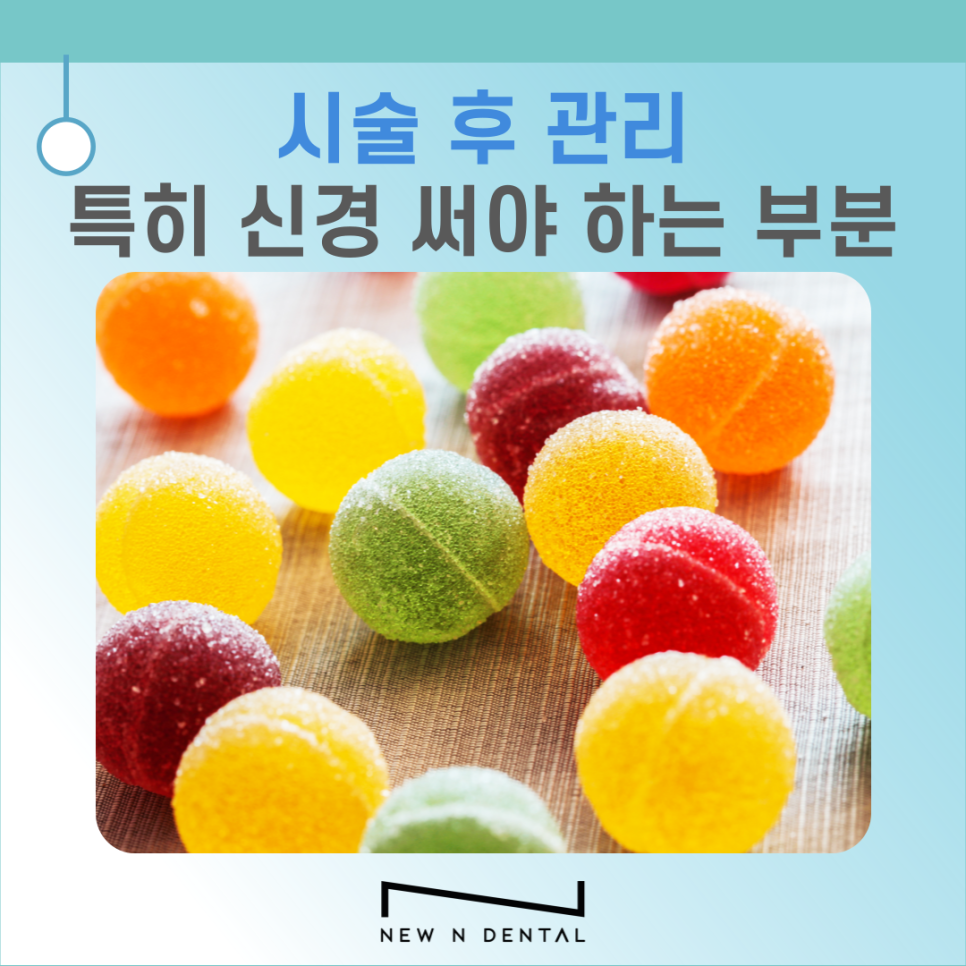 20대 임플란트 필요한 이유와 주의할 점 관련 이미지 6