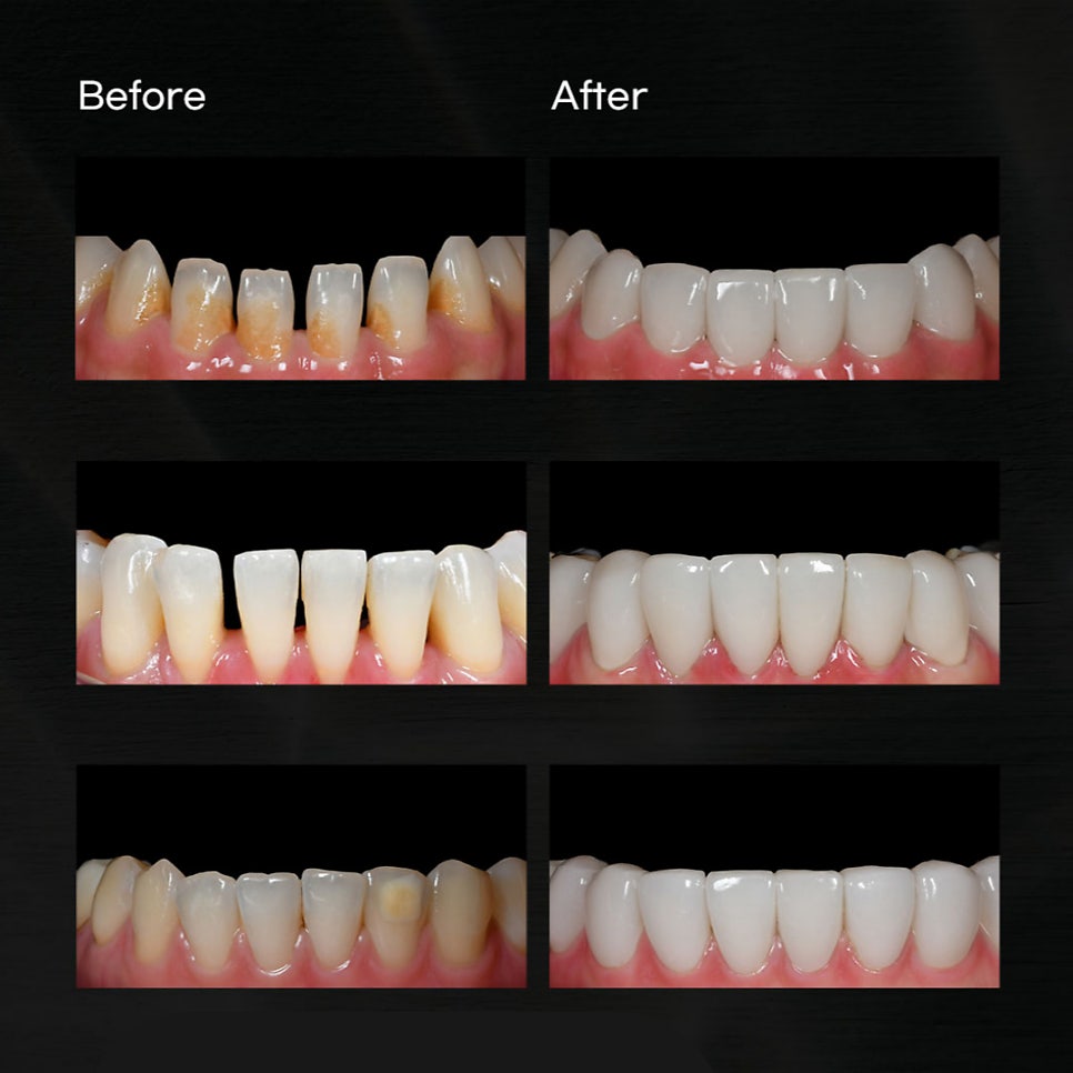 뉴엔치과만의 특별함, 퍼스널라미 관련 이미지 10