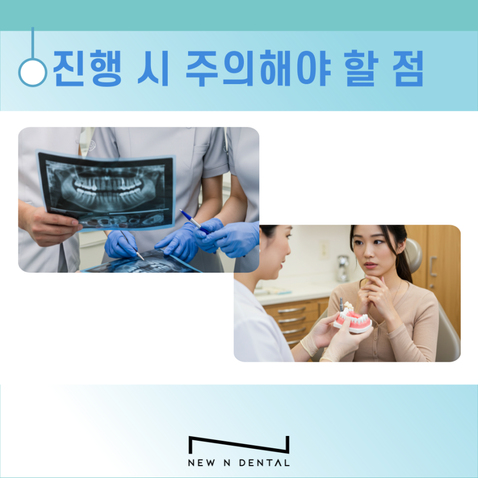 20대 임플란트 필요한 이유와 주의할 점 관련 이미지 5