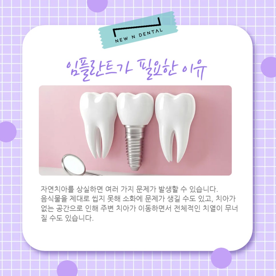 강남임플란트치과 고민 중이시라면 관련 이미지 2