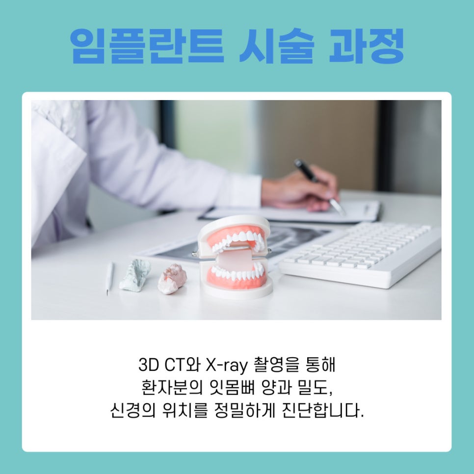 서초동치과 임플란트 오래 쓰는 비결 사후관리 핵심 포인트 관련 이미지 8