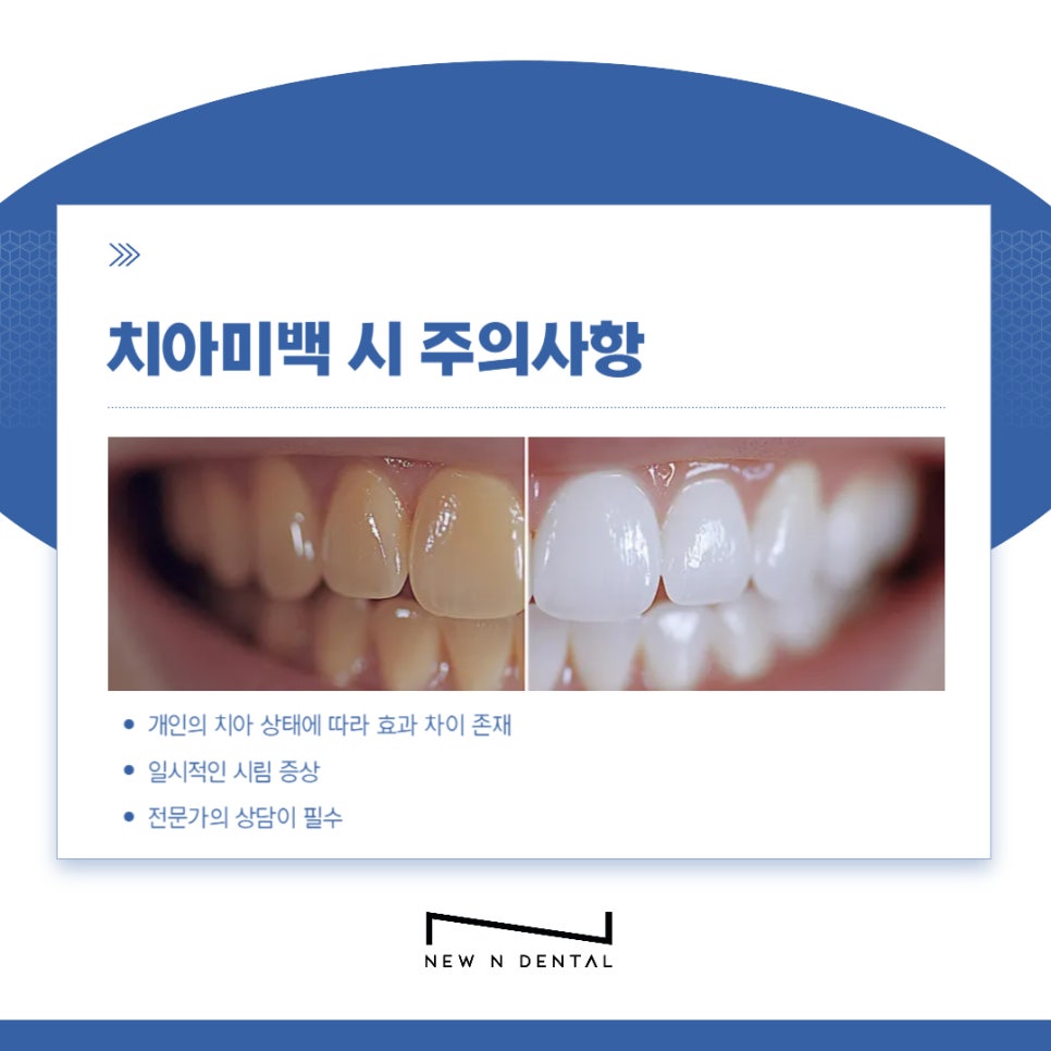강남치과 치아미백, 누런치아 하얗게 만드는 방법은 관련 이미지 7