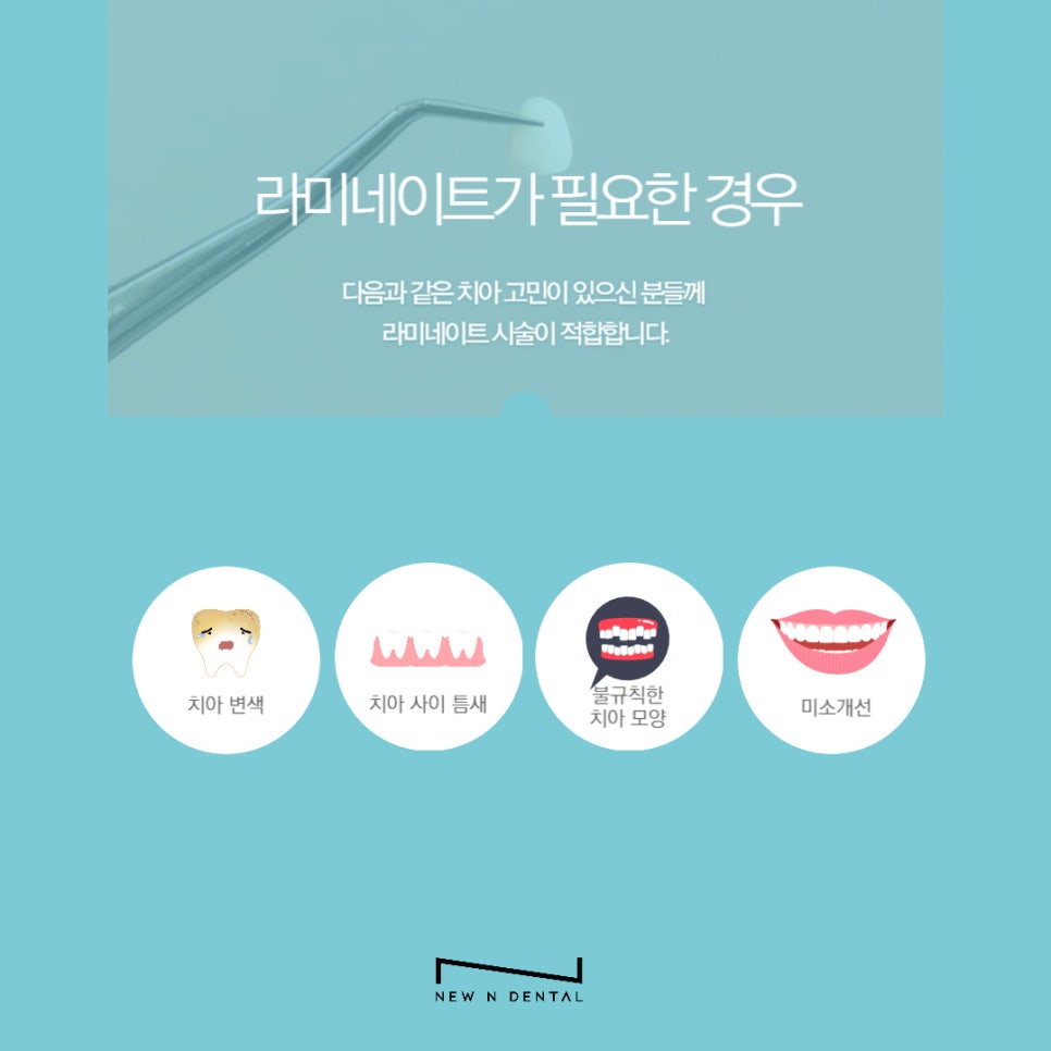 강남라미네이트 잘하는 곳 뉴엔치과 관련 이미지 6