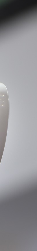 치아 스케일링 주기, 비용, 보험적용 관련 이미지 24