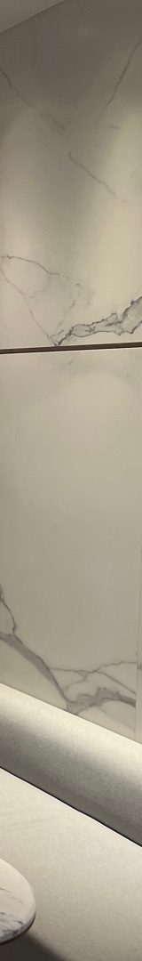 신논현치과 치아 삭제 없이 깔끔한 미소 관련 이미지 24