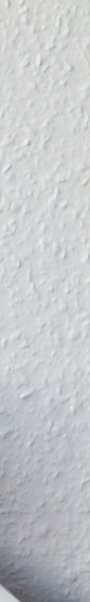 이시림 증상 원인 및 예방 방법 관련 이미지 26