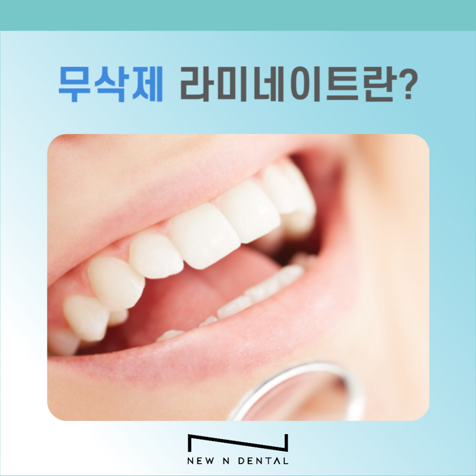 무삭제 라미네이트는 어떤 경우에 적합할까? 관련 이미지 3