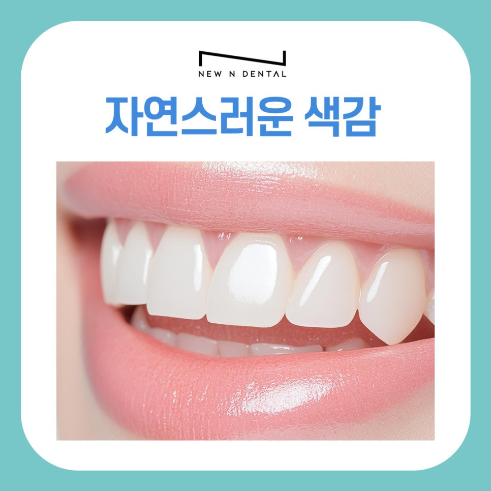 강남역치과 라미네이트 방법, 단계별로 알아보기 관련 이미지 4
