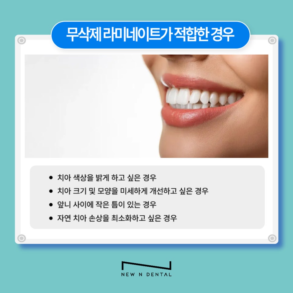 강남역치과 무삭제라미네이트 자신있게 관련 이미지 4