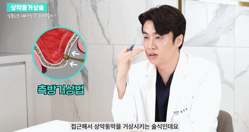논현역치과 상악동거상술 어떤 치료일까 관련 이미지 12