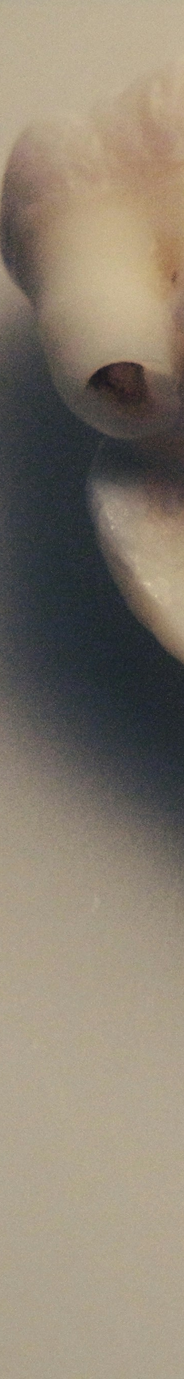 사랑니 발치 전 후 관리법 꿀팁 관련 이미지 19