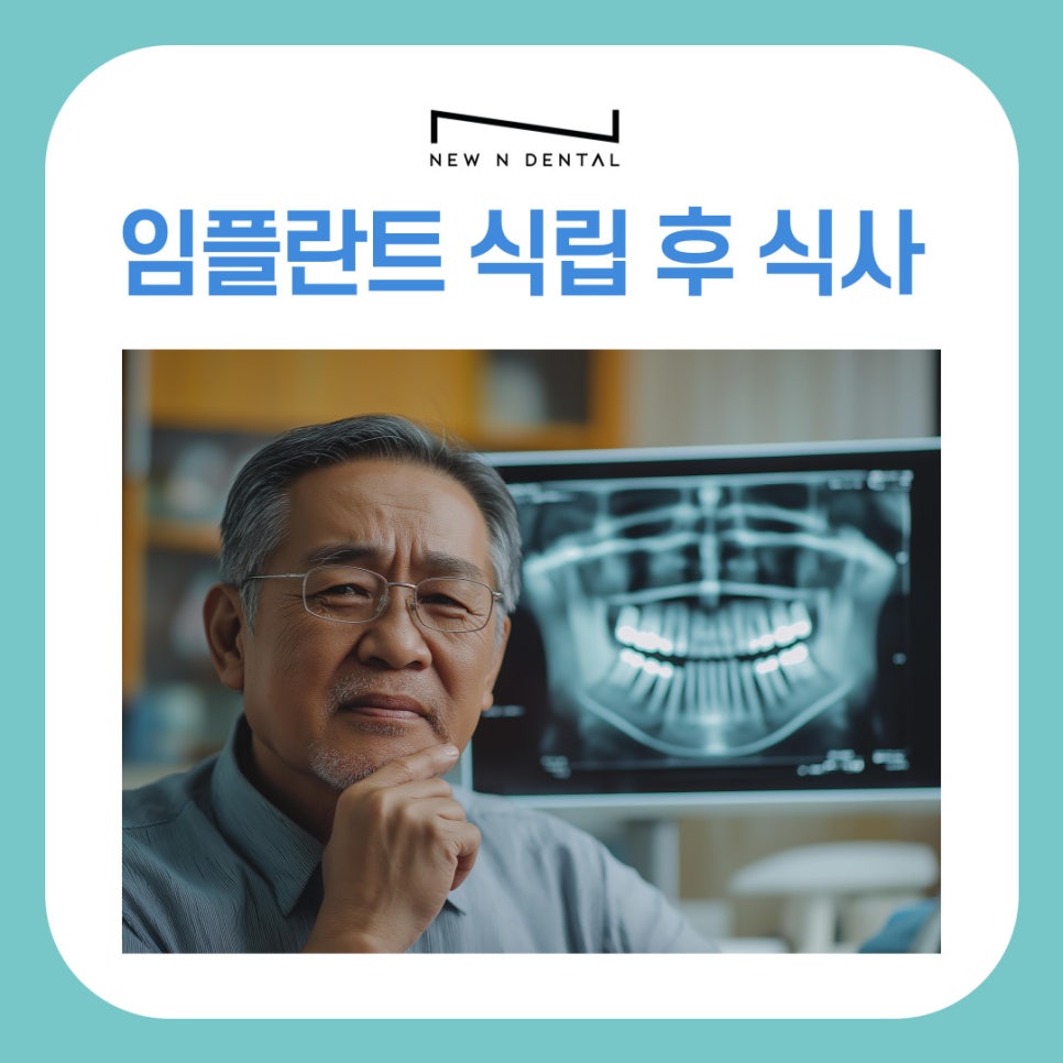 강남역치과 임플란트 식립 후 식사, 회복 과정 따라 달라지는 식단 팁 관련 이미지 2