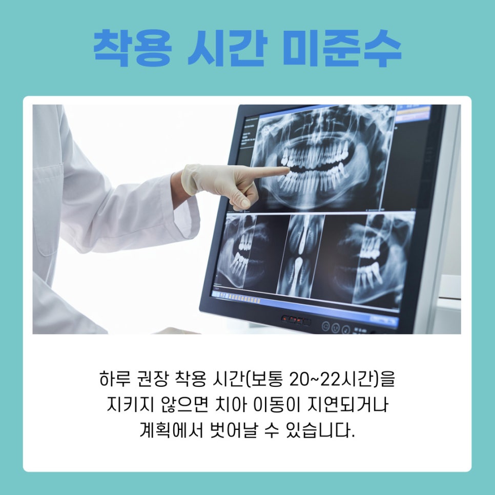 강남역 투명교정 이 부분 놓치면 후회할 수 있습니다 관련 이미지 8