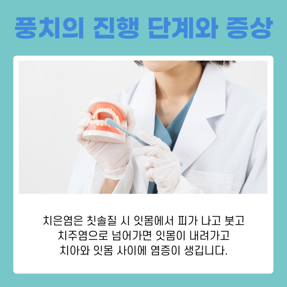 강남역치과 풍치치료법 스케일링으로 잇몸건강 되찾는 법 관련 이미지 3