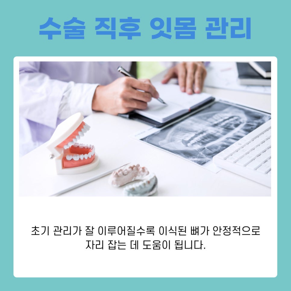 강남 역삼동 임플란트 뼈이식 과정과 회복 기간 이것만 알면 끝 관련 이미지 5
