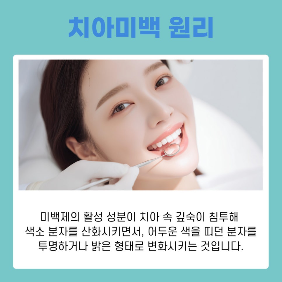 강남역치과 치아미백 원리부터 관리 방법 까지 관련 이미지 4