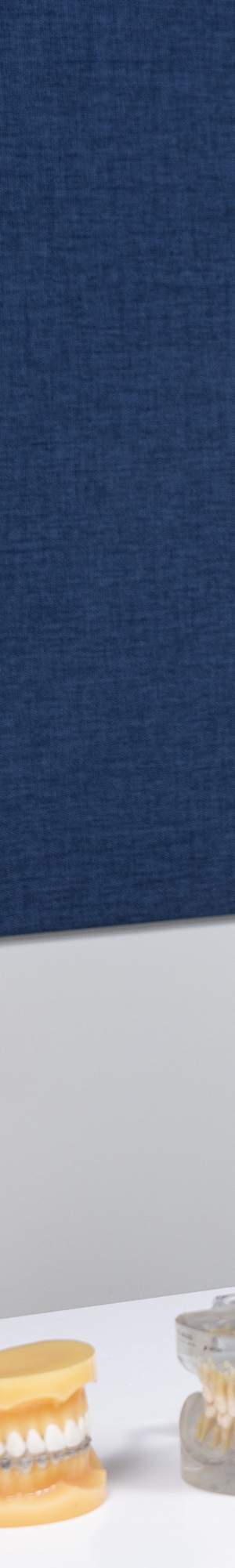 앞니 벌어짐 치료의 원인과 치료 방법 관련 이미지 16