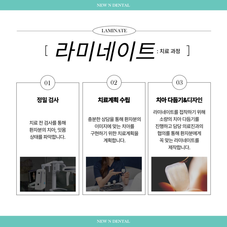 앞니심미치료로 되찾는 자연스러운 스마일 라인 관련 이미지 6