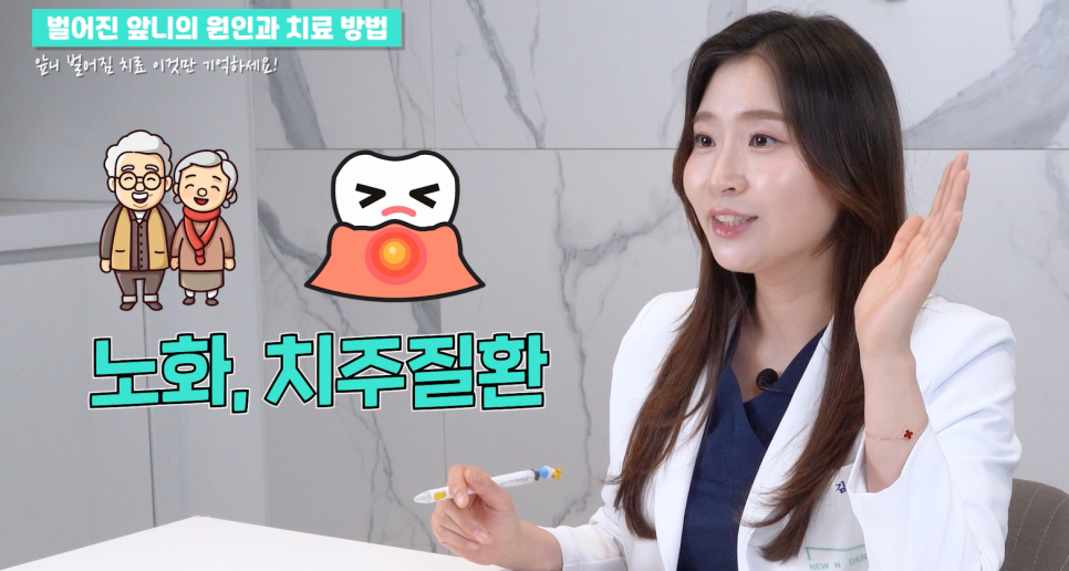 앞니 벌어짐 치료의 원인과 치료 방법 관련 이미지 7