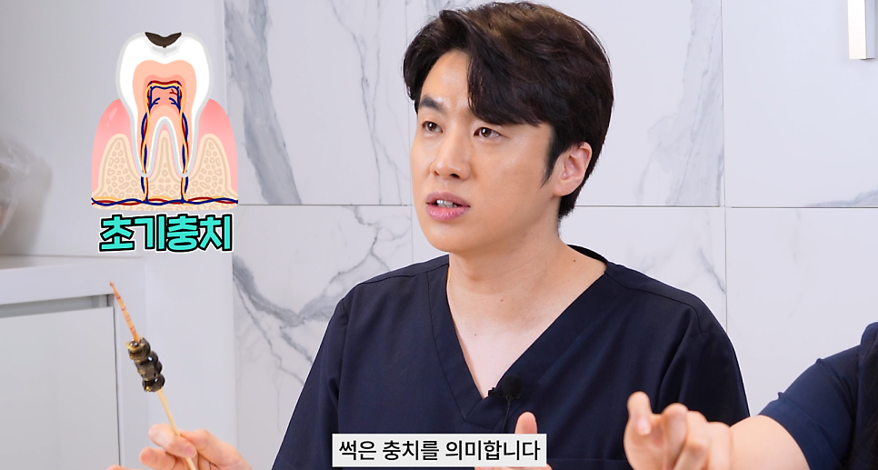 탕후루충치 치아건강에 미치는 영향과 예방법 관련 이미지 8