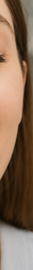 무삭제 라미네이트 저도 받을 수 있을까요? 관련 이미지 14