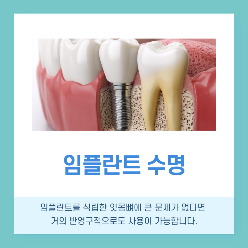 강남역치과 임플란트 수명 얼마나 사용할 수 있을까? 관련 이미지 3